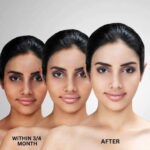 How Quickly Can You Expect to See Visible Results from Skin Lightening Supplements?