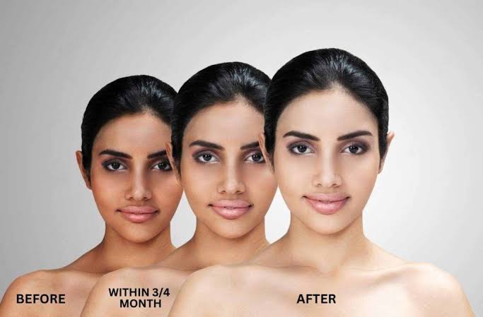 How Quickly Can You Expect to See Visible Results from Skin Lightening Supplements?